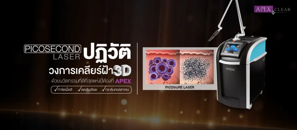 เลเซอร์ฝ้า