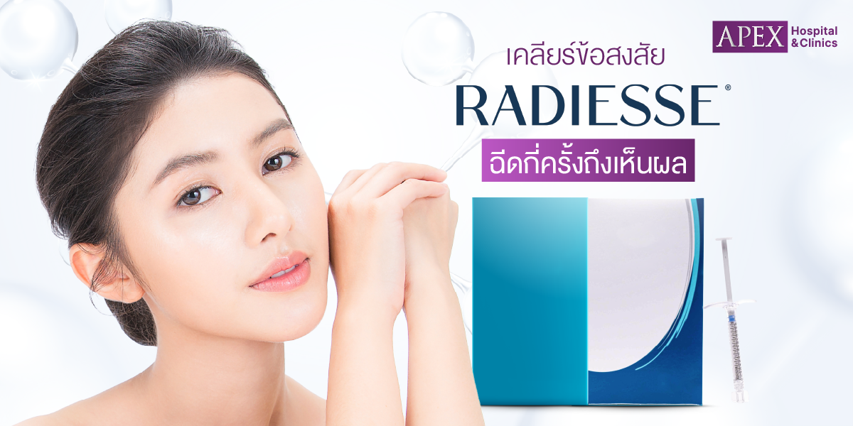 Radiesse ฉีดกี่ครั้งเห็นผล