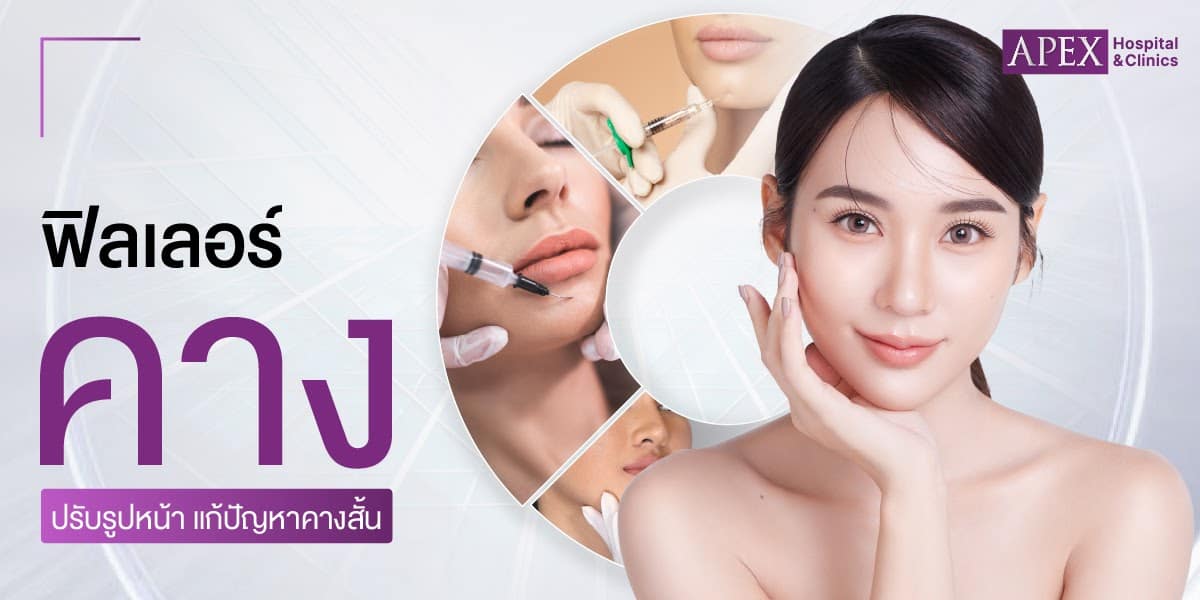 ฟิลเลอร์คาง