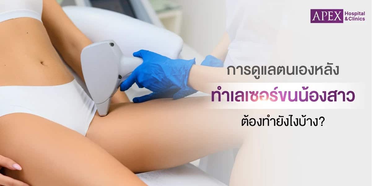 การดูแลตนเองหลังเลเซอร์ขนจิมิ