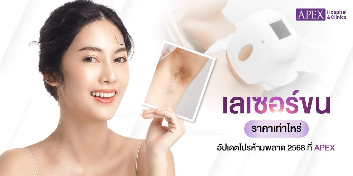 เลเซอร์ขน ราคา