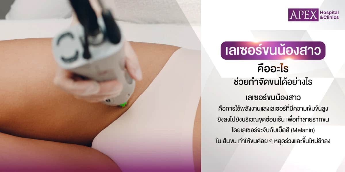 เลเซอร์ขนจิมิ ข้อเสีย