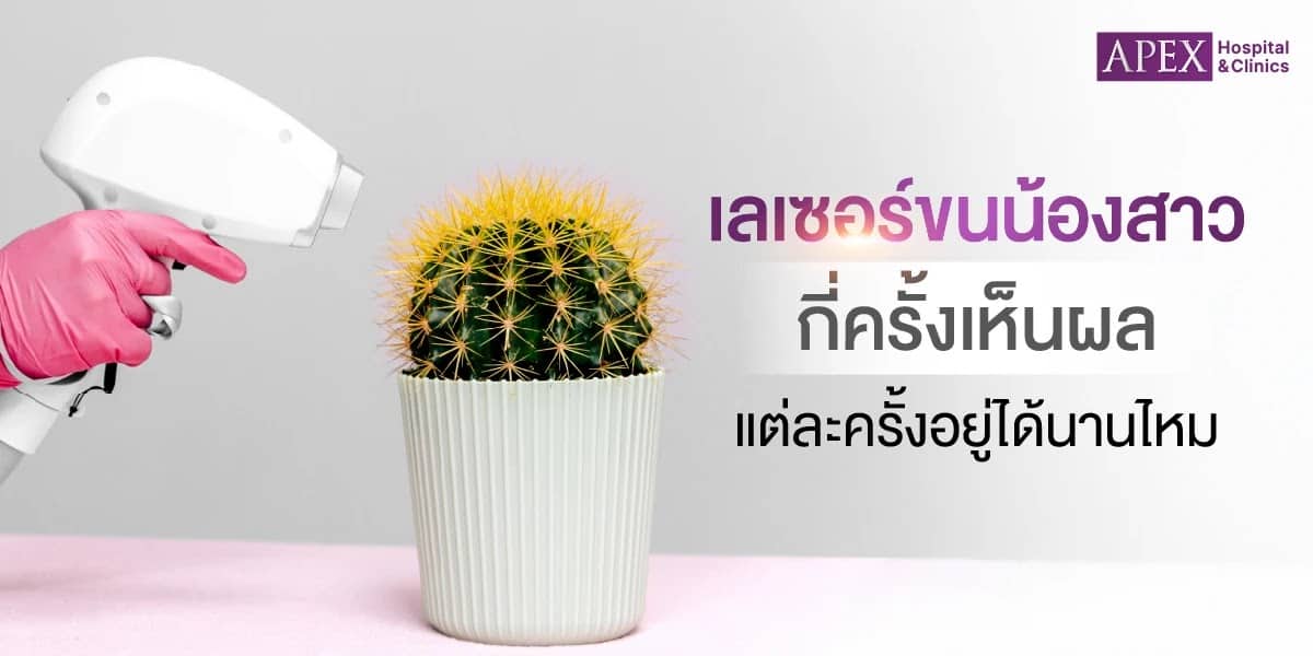 เลเซอร์ขนจิมิกี่ครั้งเห็นผล