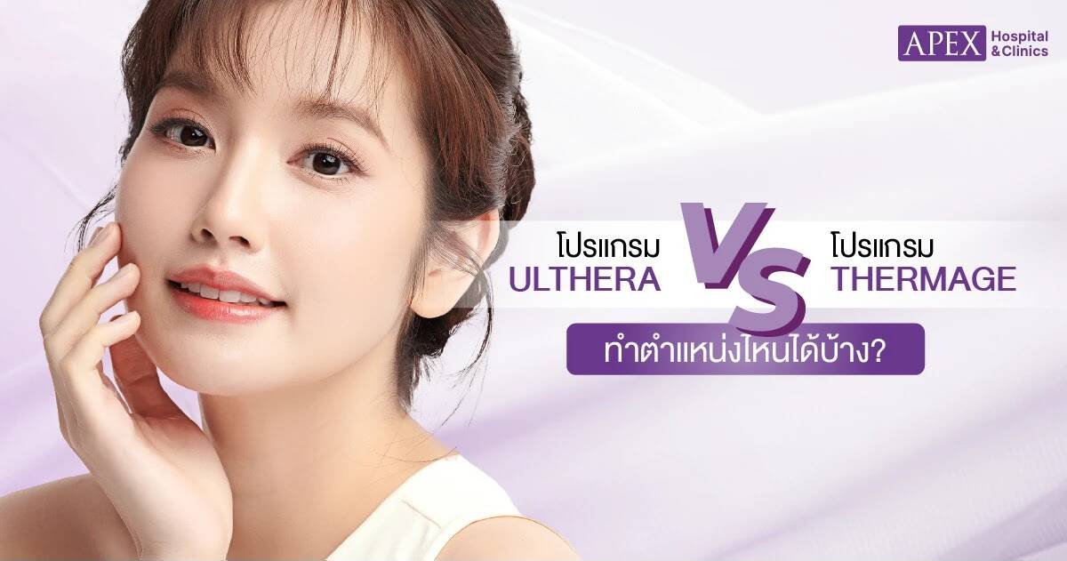 ตำแหน่งที่ทำ Ulthera vs Thermage
