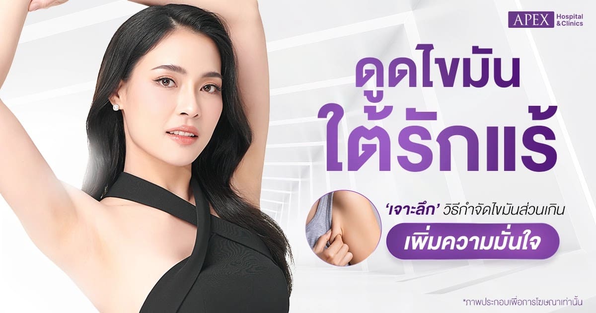 ดูดไขมันใต้รักแร้