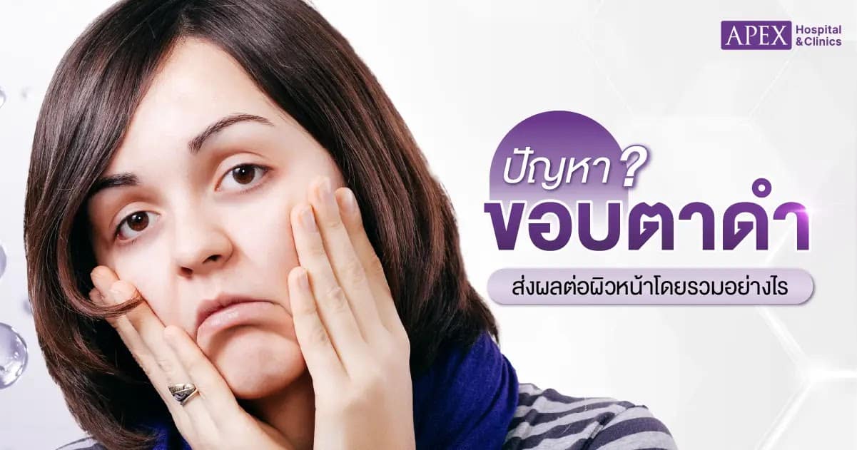 ปัญหาขอบตาดำ