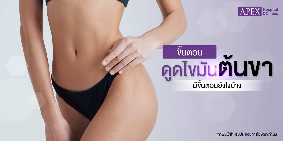 ขั้นตอนดูดไขมันต้นขา