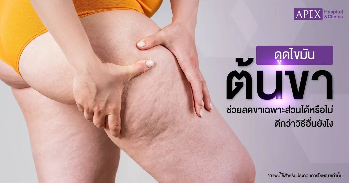 ดูดไขมันต้นขา