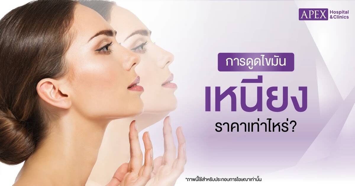 ราคาดูดไขมันเหนียง