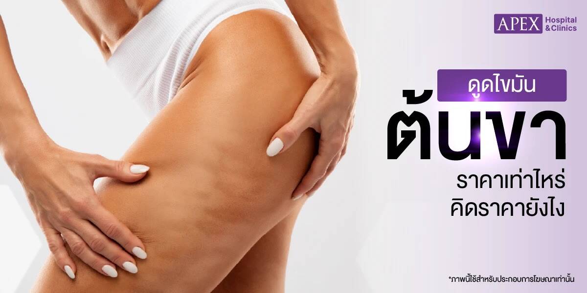 ราคาดูดไขมันต้นขา