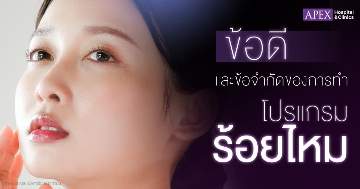 ข้อดีข้อเสียร้อยไหม