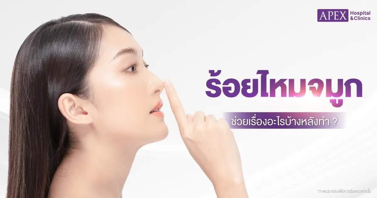 ร้อยไหมจมูกช่วยเรื่องอะไร