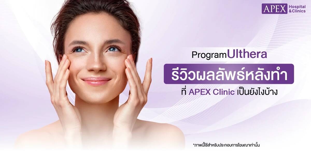 ผลลัพธ์ทำ Ulthera