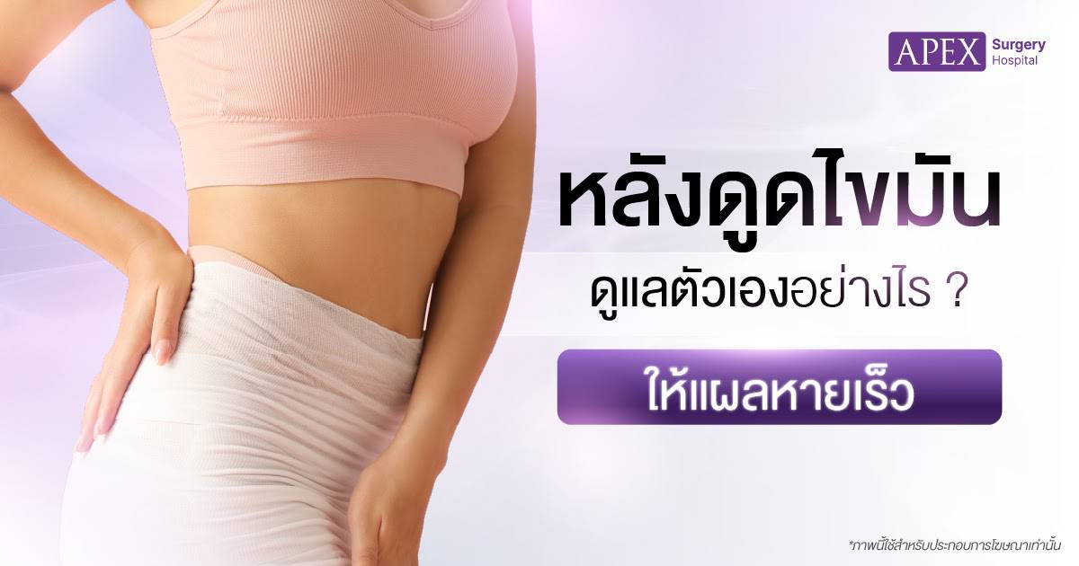 หลังดูดไขมัน