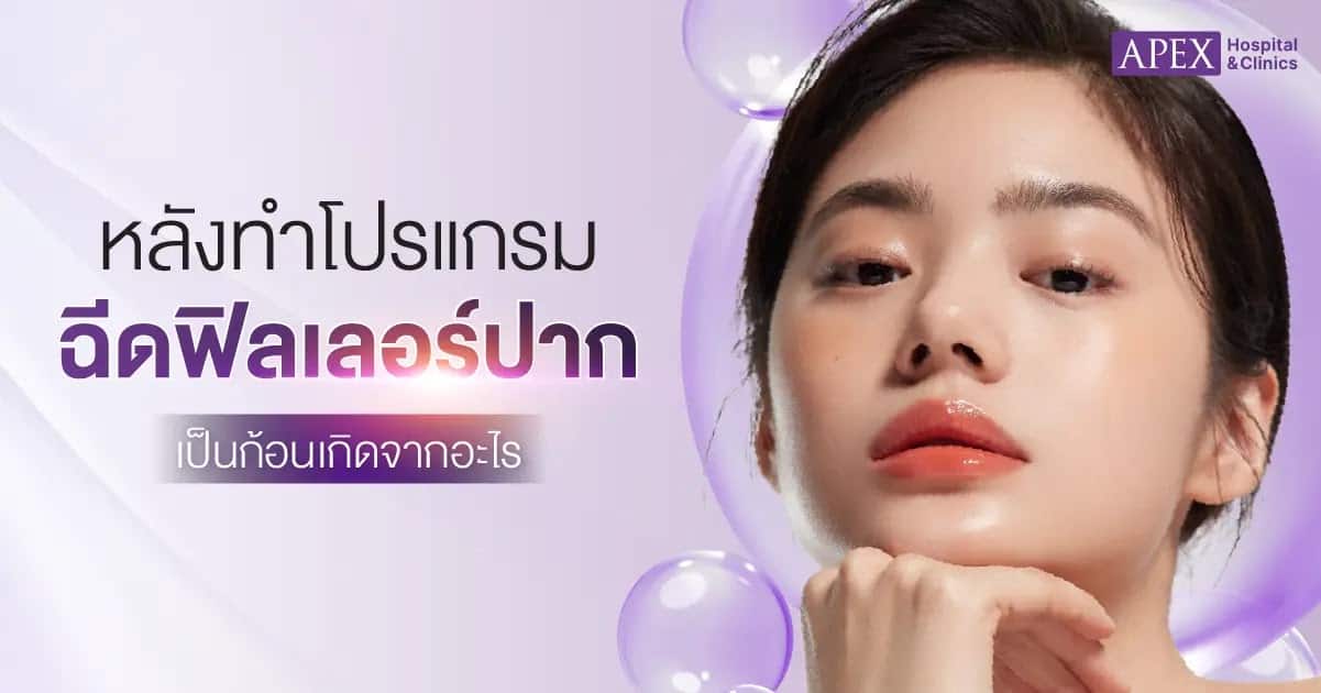 สาเหตุฉีดฟิลเลอร์ปาก เป็นก้อน