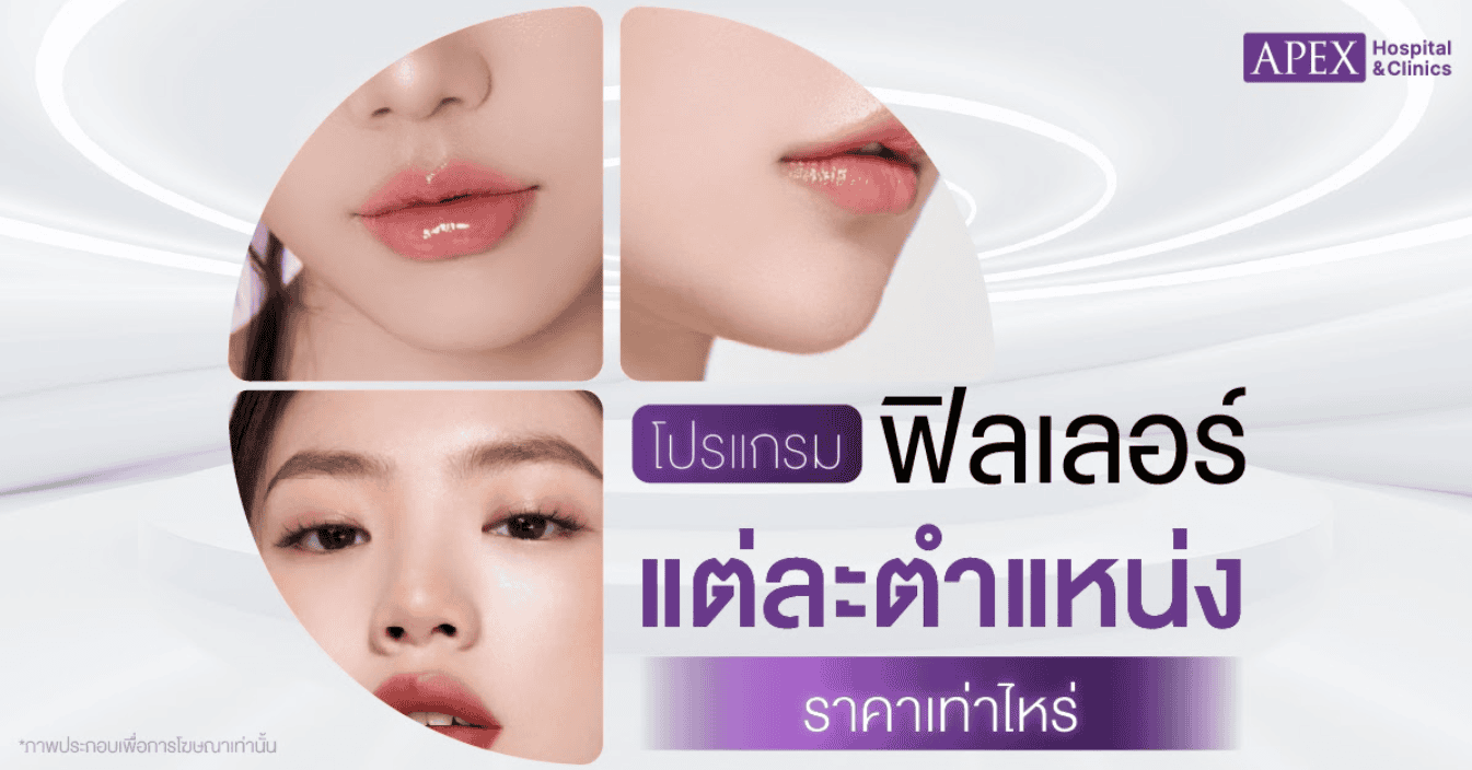 ฟิลเลอร์ ราคาเท่าไหร่แต่ละตำแหน่ง