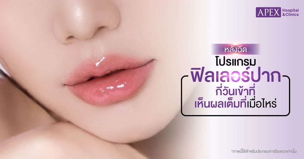 หลังฉีดฟิลเลอร์ปากกี่วันเข้าที่