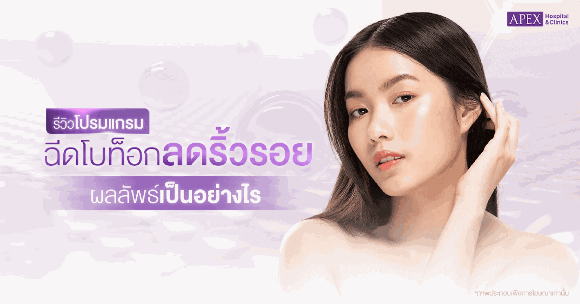 รีวิวฉีดโบท็อกลดริ้วรอย ผลลัพธ์