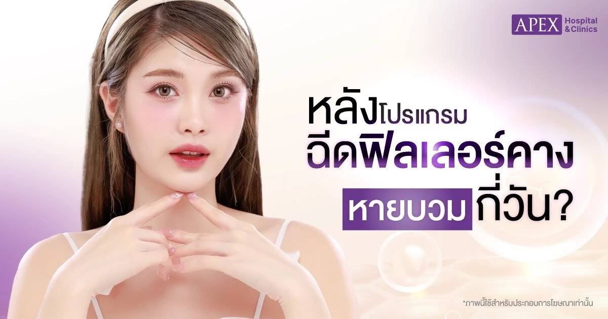 หลังฉีดฟิลเลอร์คางหายบวมกี่วัน
