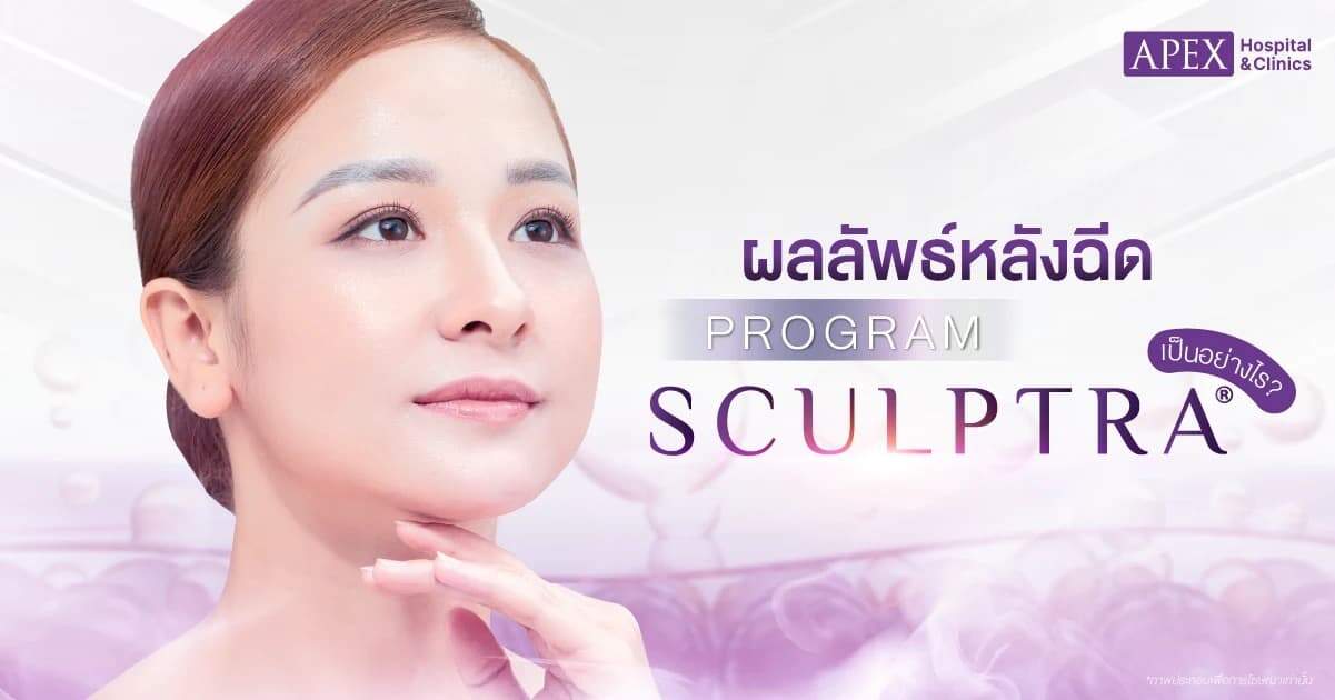 ผลลัพธ์หลังฉีด sculptra